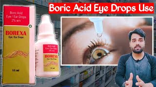 Boric acid eye drop  Boric acid powder uses  boric acid ke fayde  Medical jankari [upl. by Oigaib]