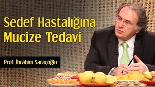 Sedef Hastalığına Mucize Tedavi  Prof İbrahim Saraçoğlu [upl. by Aserat28]