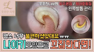 ENG SUB나이키 모양으로 꼬집고있는 발톱 때문에 평소 너무 불편하셨대요 😭 ingrown toenail  Fresh Foot 풋풋한리쌤 성수점  평내호평점 [upl. by Stephanus]