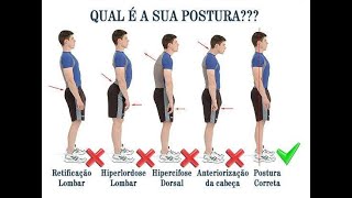 TRATAMENTO RETIFICAÇÃO CERVICAL HIPERLORDOSE LOMBAR HIPERCIFOSE DORSAL Fisioterapia Dr Robson Sitta [upl. by Parrnell]