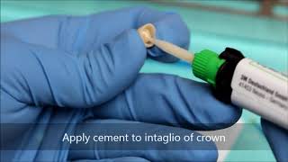 Bonding a zirconia crown [upl. by Eerdua792]