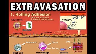 EXTRAVASATION [upl. by Eiger]