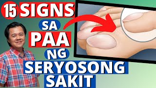 15 Signs sa Paa na may Seryosong Sakit  By Doc Willie Ong Internist and Cardiologist [upl. by Cary]