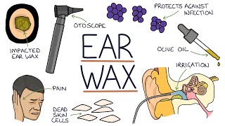 Understanding Ear Wax [upl. by Irama765]