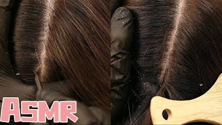 🎧ASMR｜What to do if your scalp is inflamed See how this little sister solves it [upl. by Akinehs19]