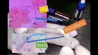 Microfilaria live and dead under Microscope [upl. by Zacharie793]