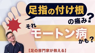 【足の専門家が教える】モートン病とは？ その正しい対策を解説 [upl. by Alidis]