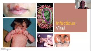 Infectious vs non infectious Part 2 of 2 [upl. by Vina]