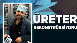 ÜRETER REKONSTRÜKSİYONU [upl. by Sivehc]