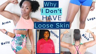 Why I Dont Have LOOSE SKIN After 100 Pound Weight Loss WITHOUT Surgery  TMI Skincare amp Nutrition [upl. by Euqinotna]