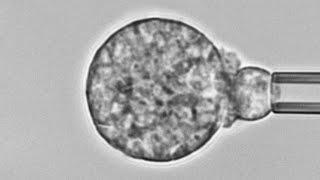 Human neutrophil versus Coccidioides cause of Valley fever Chemotaxis adhesion and phagocytosis [upl. by Shulins537]