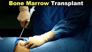 How Does Bone Marrow Transplant Works UrduHindi [upl. by Notna]