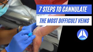 7 steps to cannulate the most difficult veins Live demonstration [upl. by Khano]