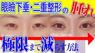 二重・眼瞼下垂整形の腫れを減らす方法を医師が解説【湘南美容クリニック眼瞼下垂・眉下切開・目の下のタルミ取りもOK】 [upl. by Fitz]