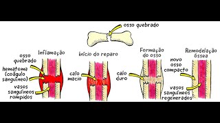 Reparo ósseo entenda a fisiopatologia e as fases de consolidação [upl. by Eiramesor]