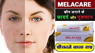 Melacare Cream Review in Hindi  मेलाकेयर के फायदे नुकसान उपयोग  देखो पूरी सच्चाई [upl. by Nirhtak]