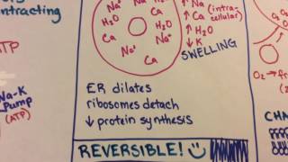 Ischemic Reperfusion Injury [upl. by Carberry179]