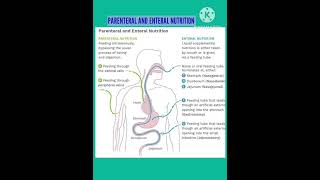 Parenteral nutrition and Enteral nutrition nursingnotes [upl. by Ymij]