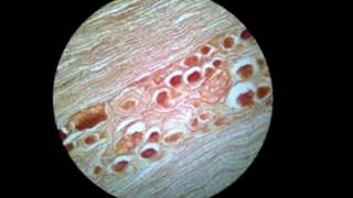 Histología del Sistema Nervioso [upl. by Cassie523]