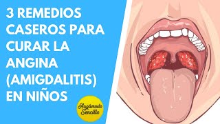 3 REMEDIOS CASEROS PARA CURAR LA ANGINA AMIGDALITIS EN BEBÉS Y NIÑOS  SÍNTOMAS DE AMIGDALITIS [upl. by Waldo815]