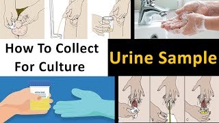 How to Collect Urine Sample For Culture [upl. by Roach]