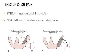 Chest Pain Rapid Review [upl. by Atsira]