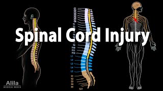 Spinal Cord Injury Animation [upl. by Johns81]