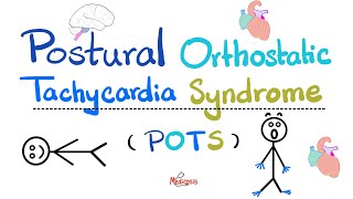 Postural Orthostatic Tachycardia Syndrome POTS  Causes Symptoms Diagnosis TreatmentCardiology [upl. by Annoved]