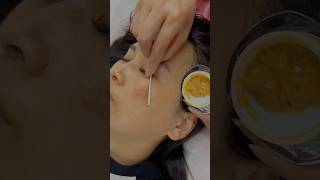 Pigmentation solution free at home shorts pigmentation skincondition diy viral youtube [upl. by Eimmat]