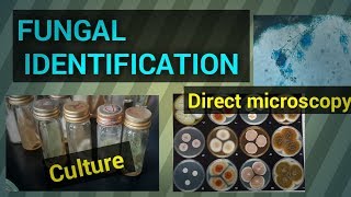 Fungal infectionFungal identificationFungal culture test procedureFungal diseaseSTAR LABORATORY [upl. by Geiger686]