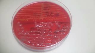 Klebsiella and Staphylococcus growth on CLED agar Uropathogens [upl. by Asiluy]