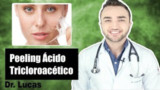 Peeling Ácido Tricloroacético ATA TCA  Dr Lucas Fustinoni [upl. by Ebeohp]