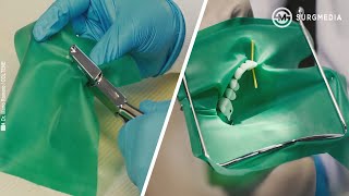 Basics of Dental Rubber Dam Placement [upl. by Yrallih]