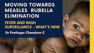 Measles Rubella Elimination amp Fever Rash Surveillance  Dr Prathapa Chandran C [upl. by Malinde]