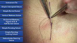 Learn How To Suture  Best Suture Techniques and Training [upl. by Wonacott]