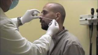 Procedure for Nasopharyngeal Swabs and Aspirates [upl. by Booma]