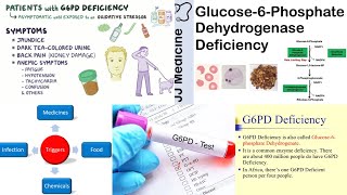 G6PD deficiency symptoms causes diagnosis amp treatment [upl. by Anael]