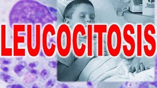 LEUCOCITOSIS  INFECCION POR AUMENTO DE GLÓBULOS BLANCOS [upl. by Trebleht]