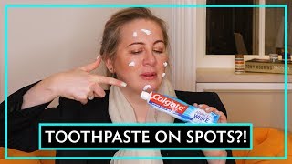 Dr Debunks Does Toothpaste Get Rid Of Spots [upl. by Eatnahs]