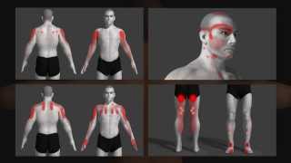 trigger point uitleg animatie Dutch [upl. by Beekman]