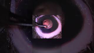 Deep Corneal Ulcer shorts veterinaryophthalmology [upl. by Toh]