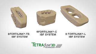 FortilinkC IBF System with TETRAfuse 3D Technology [upl. by Assenov364]