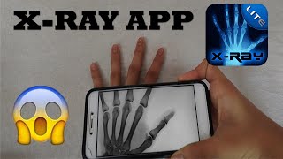 XRay App [upl. by Lednor]