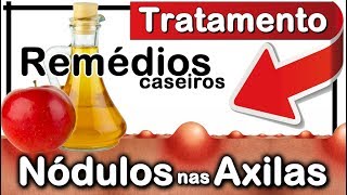 🔥 COMO ACABAR COM NÓDULOS NAS AXILAS EM 24 HORAS OU MENOS Remédios Caseiros Caroço no Suvaco [upl. by Annia]