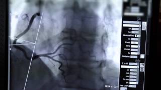 Ureteral Stents What You Need to Know  Urology Care Foundation [upl. by Cristiano]