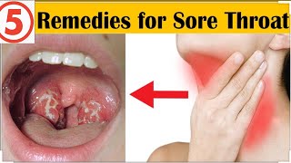 5 HOME REMEDIES FOR SORE THROAT  MED IN A MINUTE DampN Medical Series [upl. by Hands]