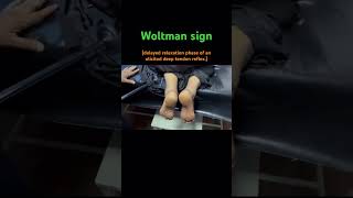 Woltman sign  hypothyroidismdelayed relaxation phase of an elicited DTR  clinical neurology [upl. by Aihsyla]