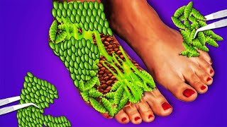 ASMR removal Big worm and maggot infected leg ASMR leg treatment ASMR 2d deep cleaning animation [upl. by Schonthal]