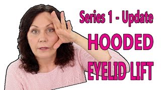 Droopy Eyelid Remedy  Facerobics Facial Exercises [upl. by Korenblat]