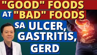 quotGoodquot Foods at quotBadquot Foods sa Ulcer Gastritis GERD  By Doc Willie Ong [upl. by Yoc498]